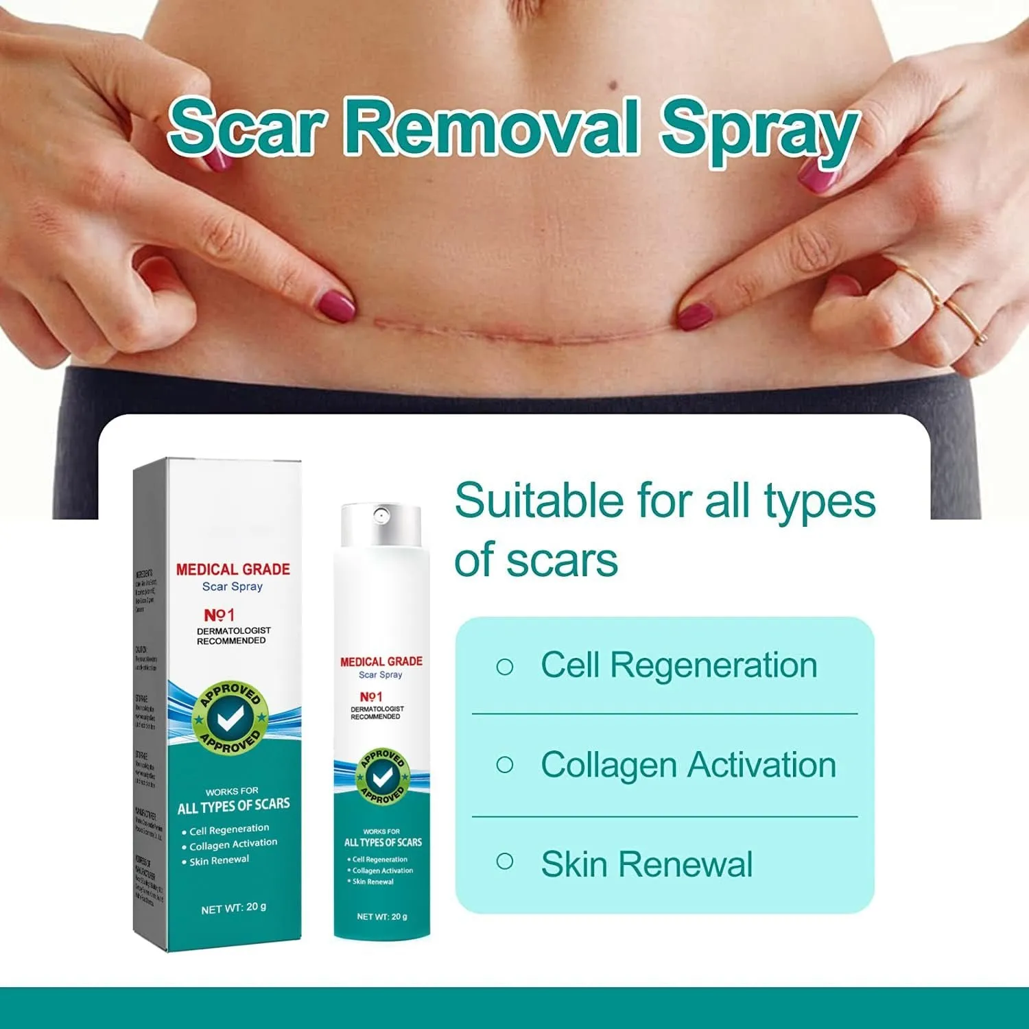 Advanced Scar Spray - Scar Removal for All Types of Scars