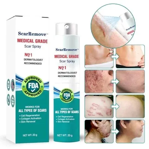 Advanced Scar Spray - Scar Removal for All Types of Scars