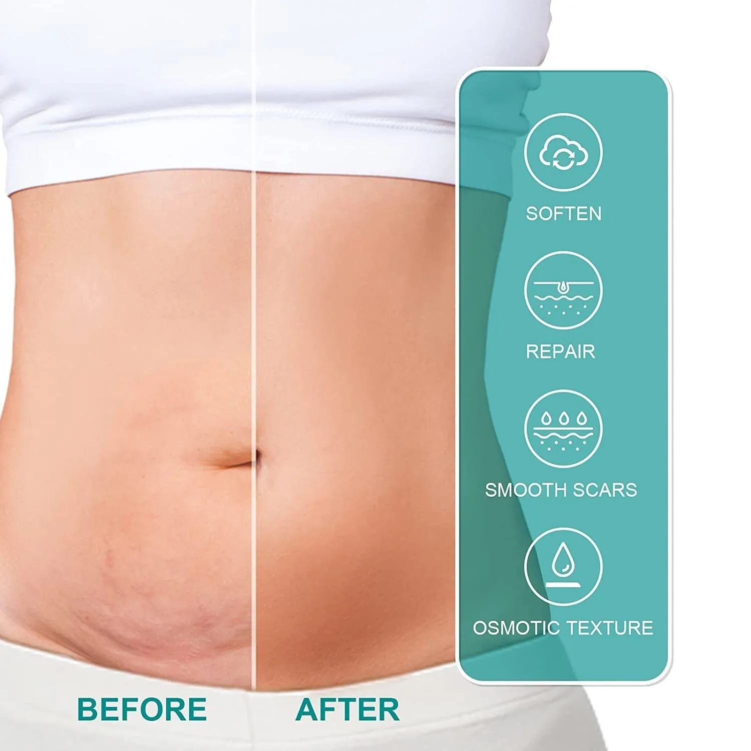 Advanced Scar Spray - Scar Removal for All Types of Scars