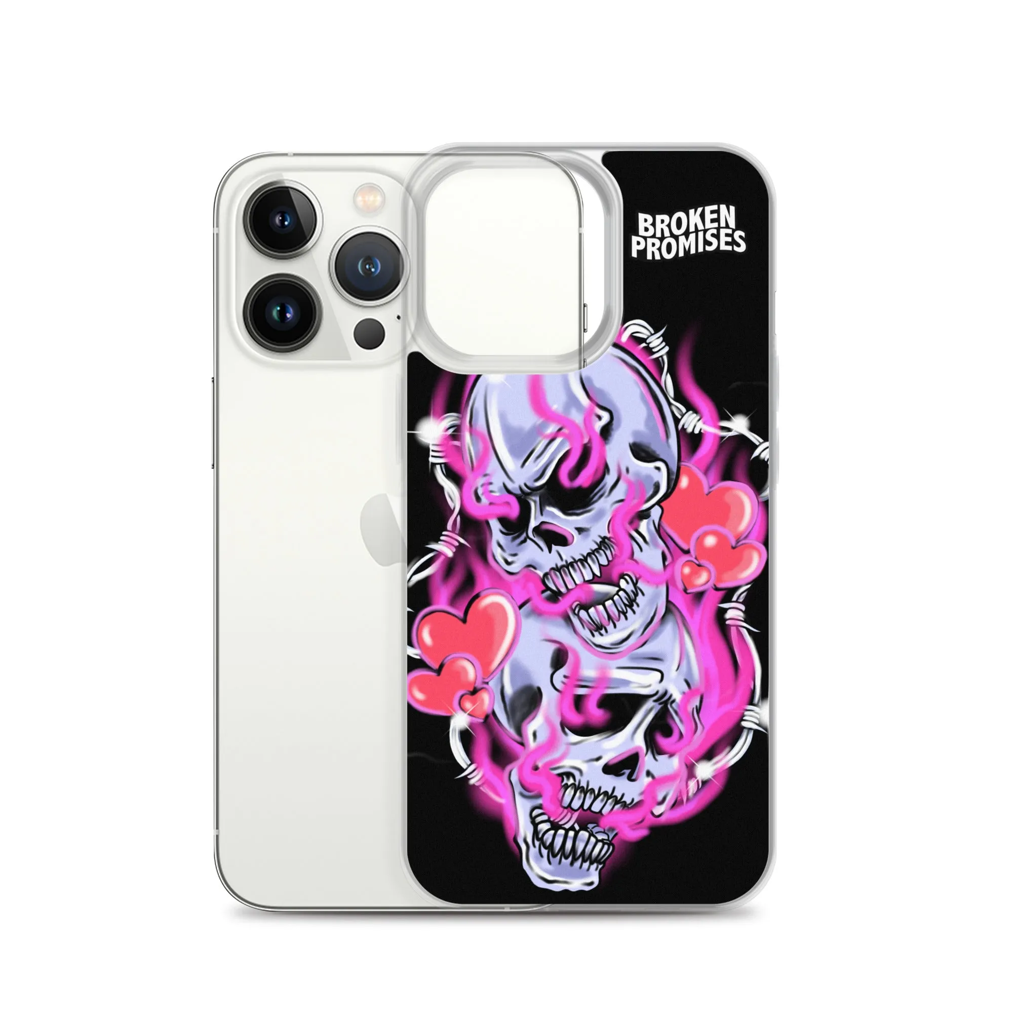 Gets Hurt iPhone Case