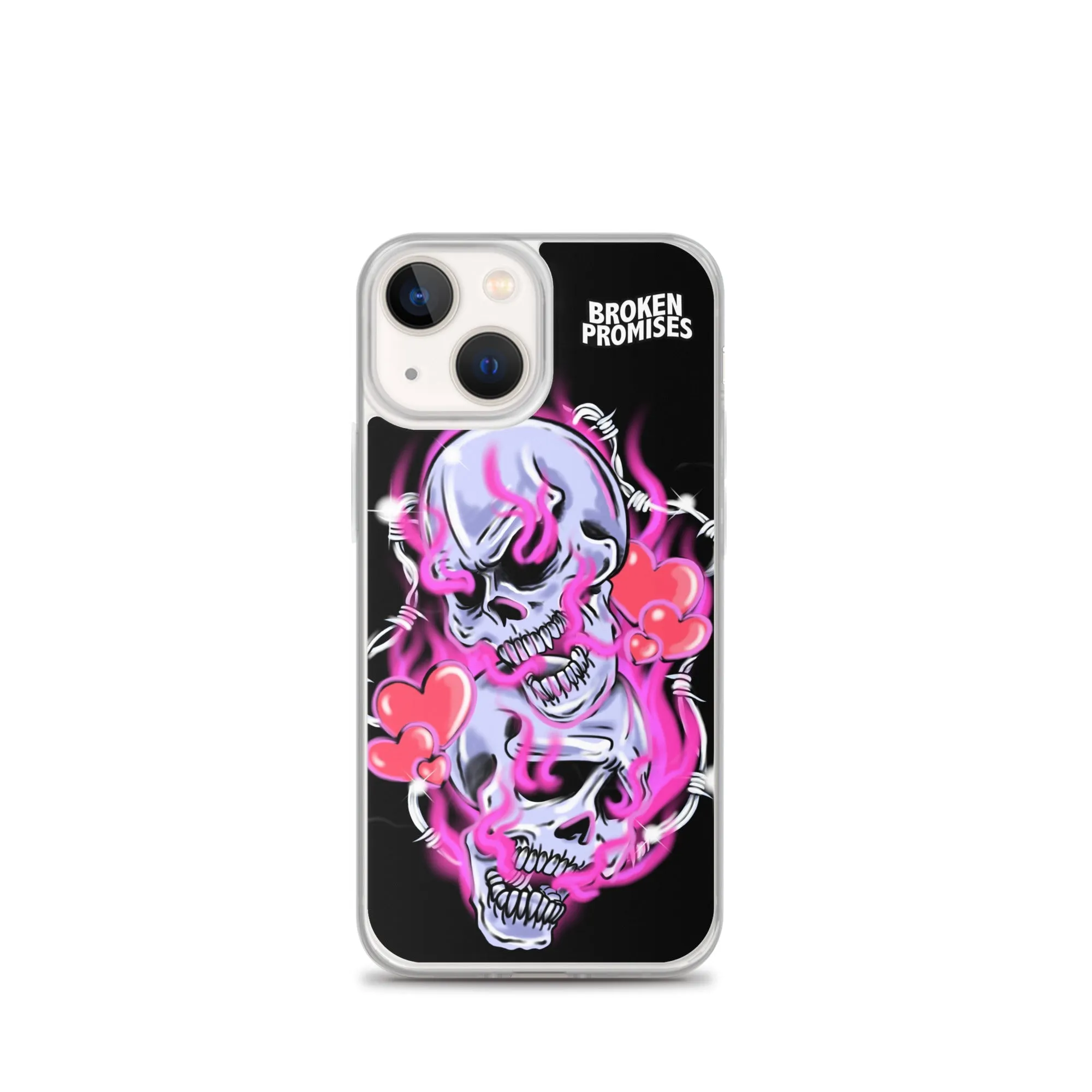 Gets Hurt iPhone Case