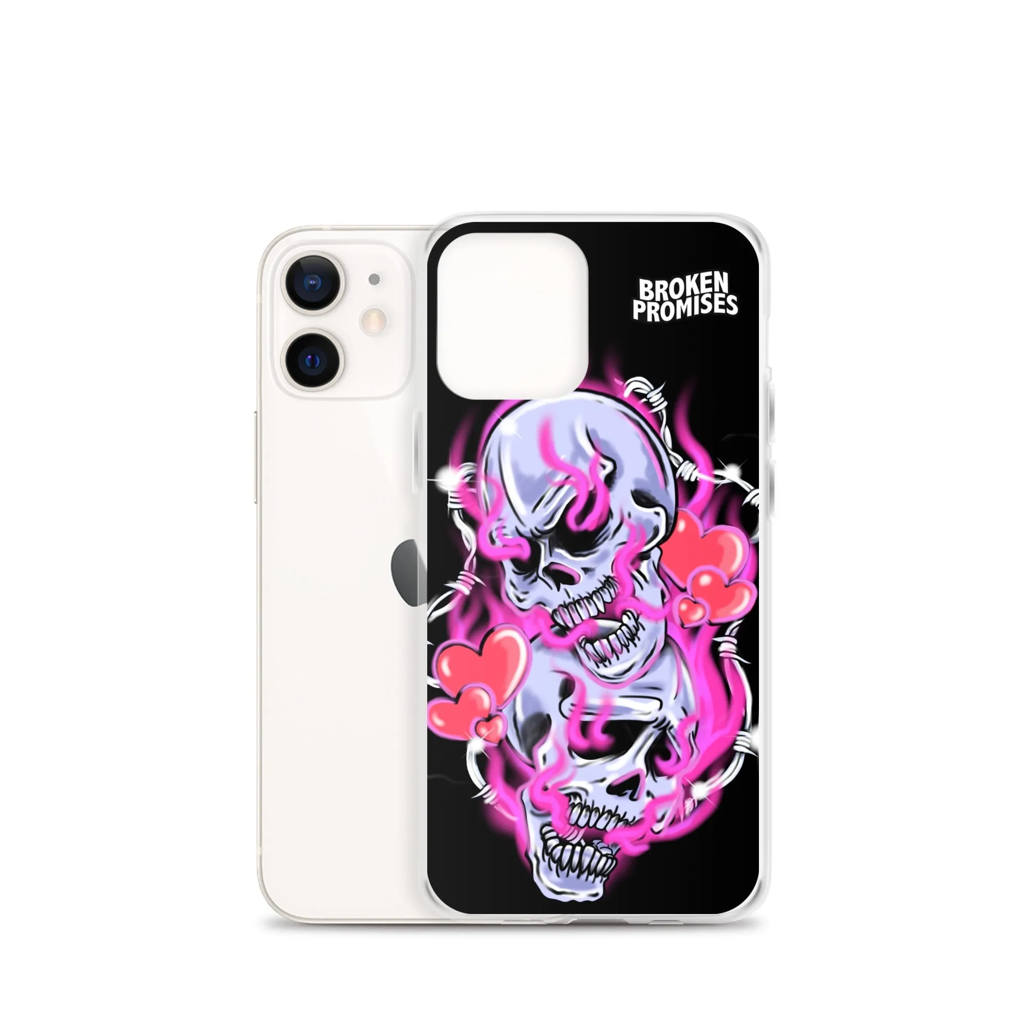 Gets Hurt iPhone Case