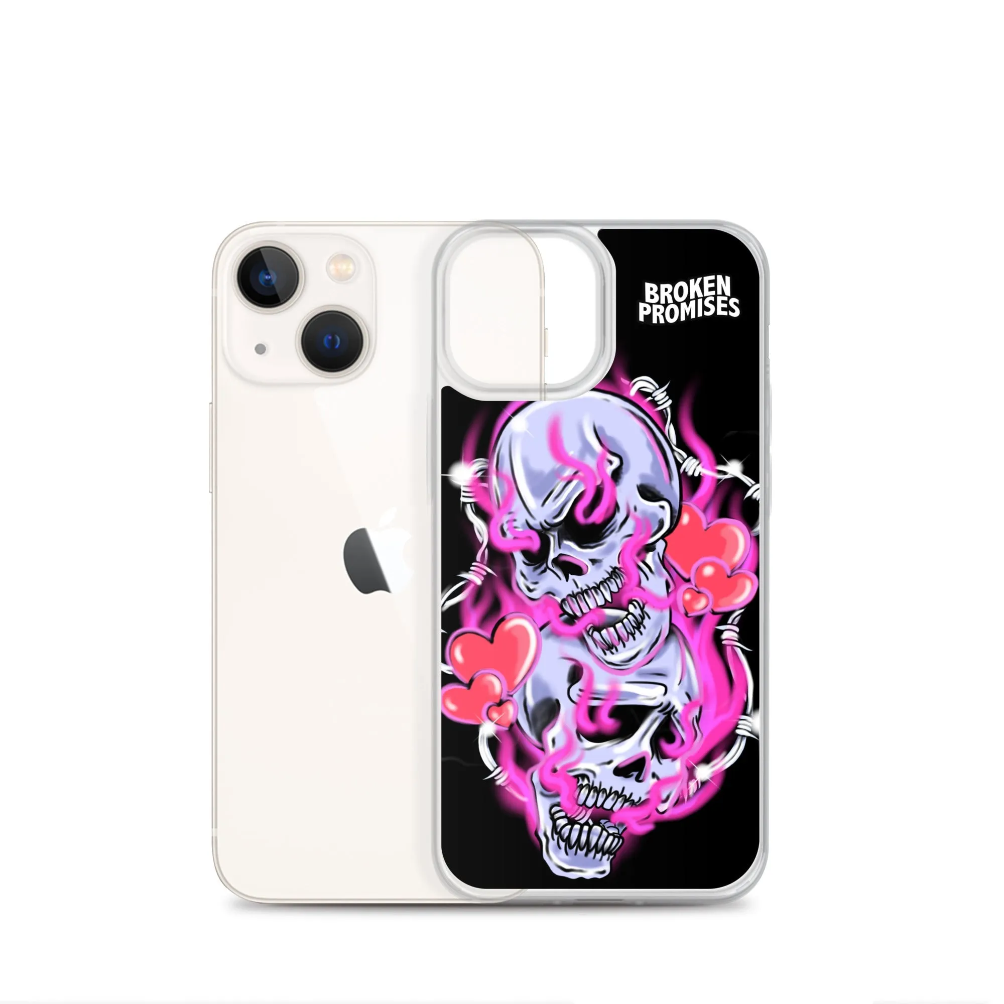 Gets Hurt iPhone Case