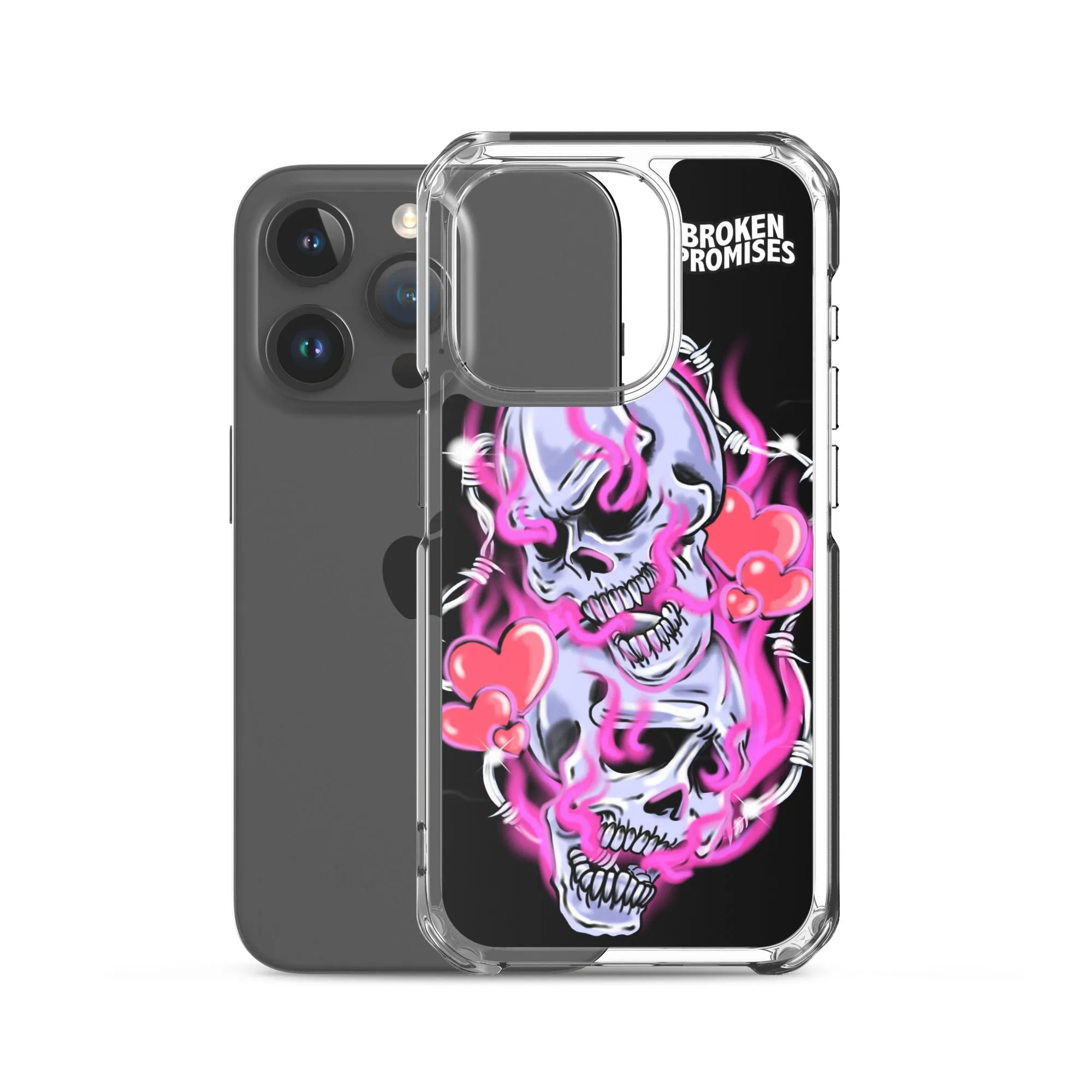 Gets Hurt iPhone Case