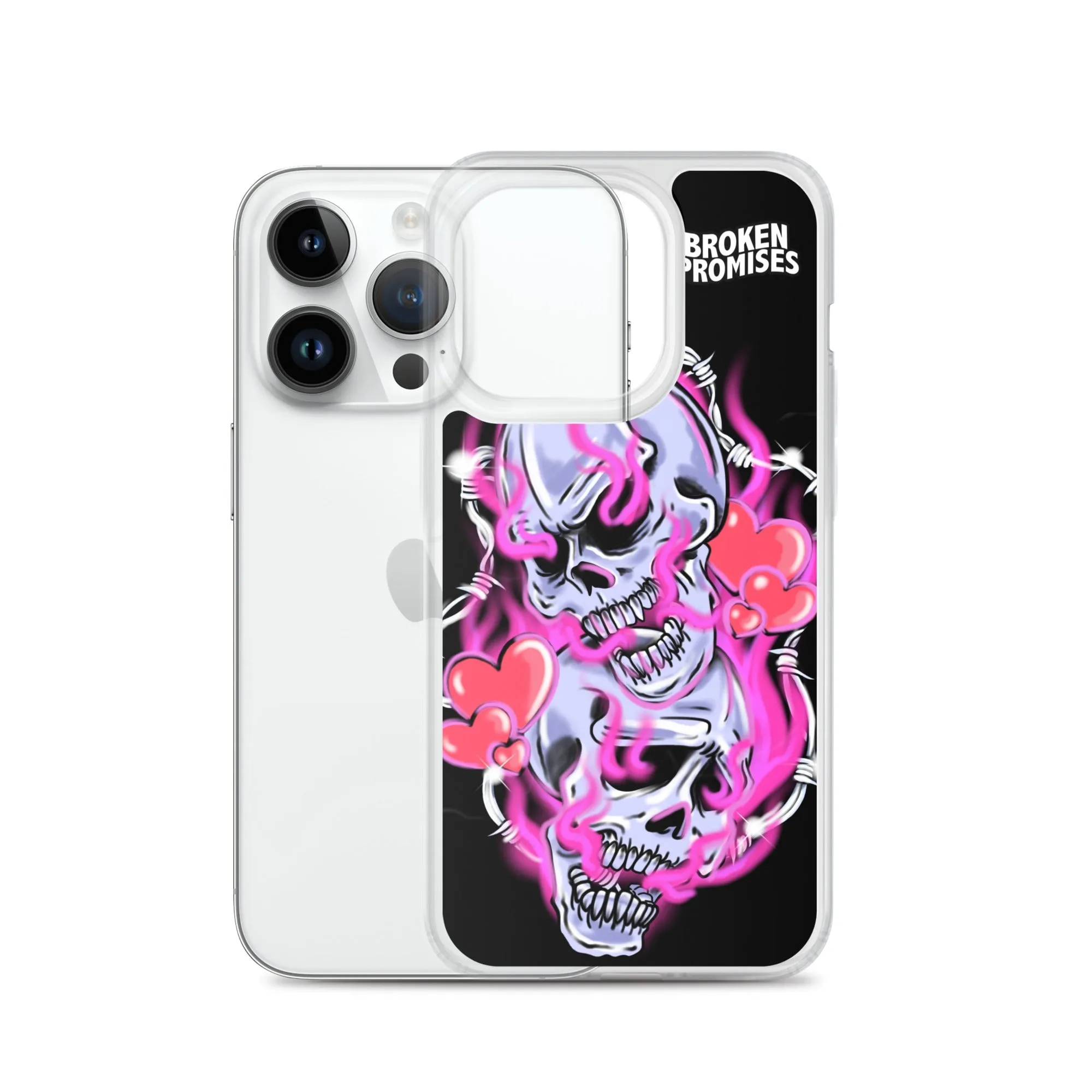 Gets Hurt iPhone Case