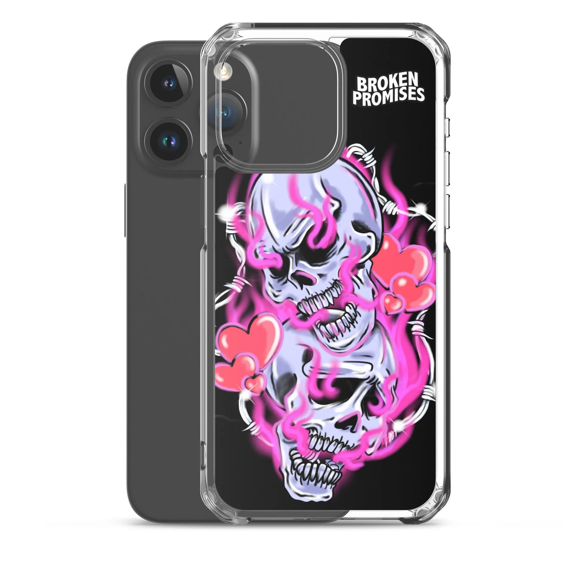 Gets Hurt iPhone Case