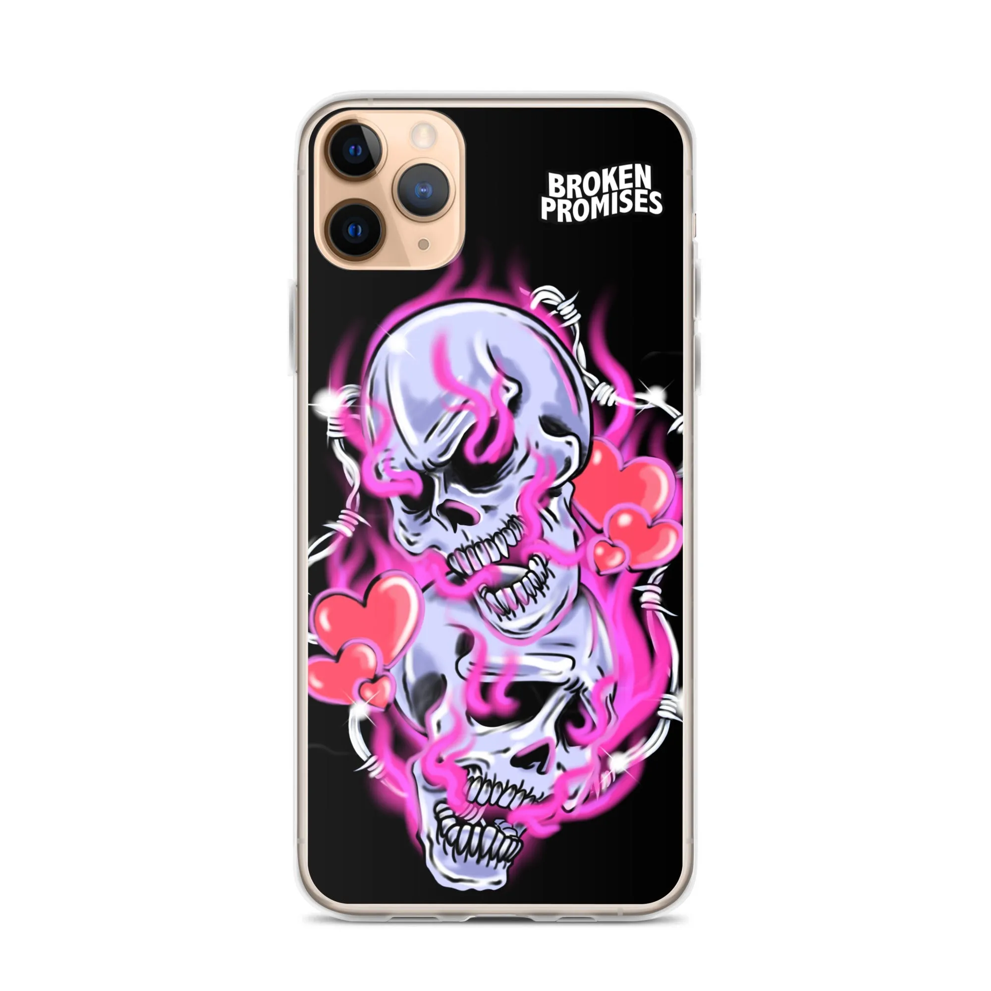 Gets Hurt iPhone Case